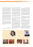 Vorschauseite 1: Wie Betroffene die Wundversorgung erleben – Den Patienten eine Stimme geben