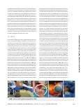 Vorschauseite 4: Handassistierte retroperitoneoskopische Nephrektomie zur Lebendspende
