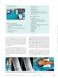 Vorschauseite 3: MILLER-Banding: Behandlung des Steal-Syndroms nach AV-Shuntanlage