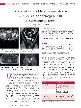 Vorschauseite 1: Anomalien und Normvarianten - Interne Veränderungen 2.18: Maldescensus testis