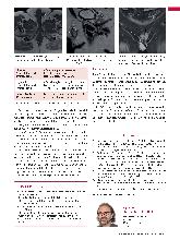Vorschauseite 2: Anomalien und Normvarianten - Interne Veränderungen 2.18: Maldescensus testis