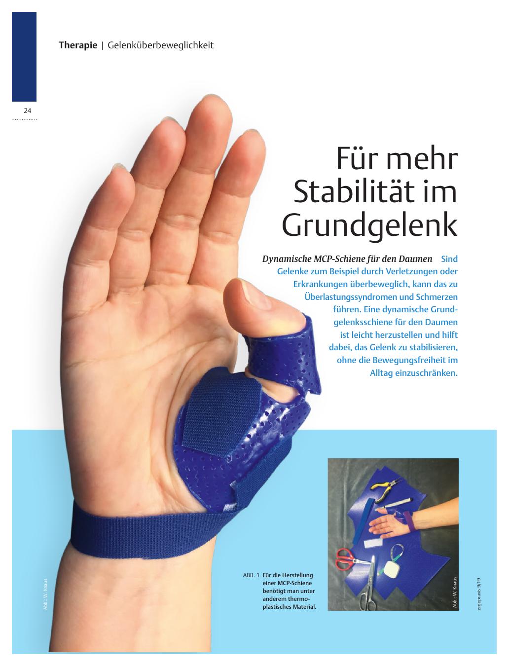 Vorschauseite 1: Für mehr Stabilität im Grundgelenk ? Dynamische MCP-Schiene für den Daumen