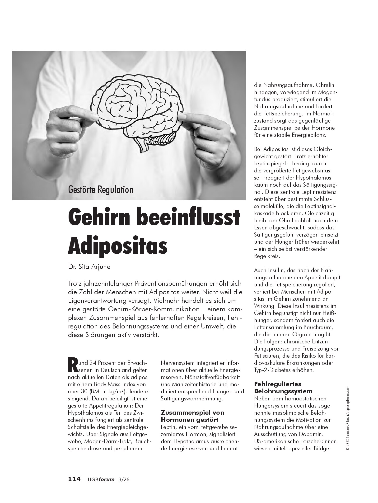 Vorschauseite 1: Gestörte Regulation: Wie das Gehirn Adipositas beeinflusst