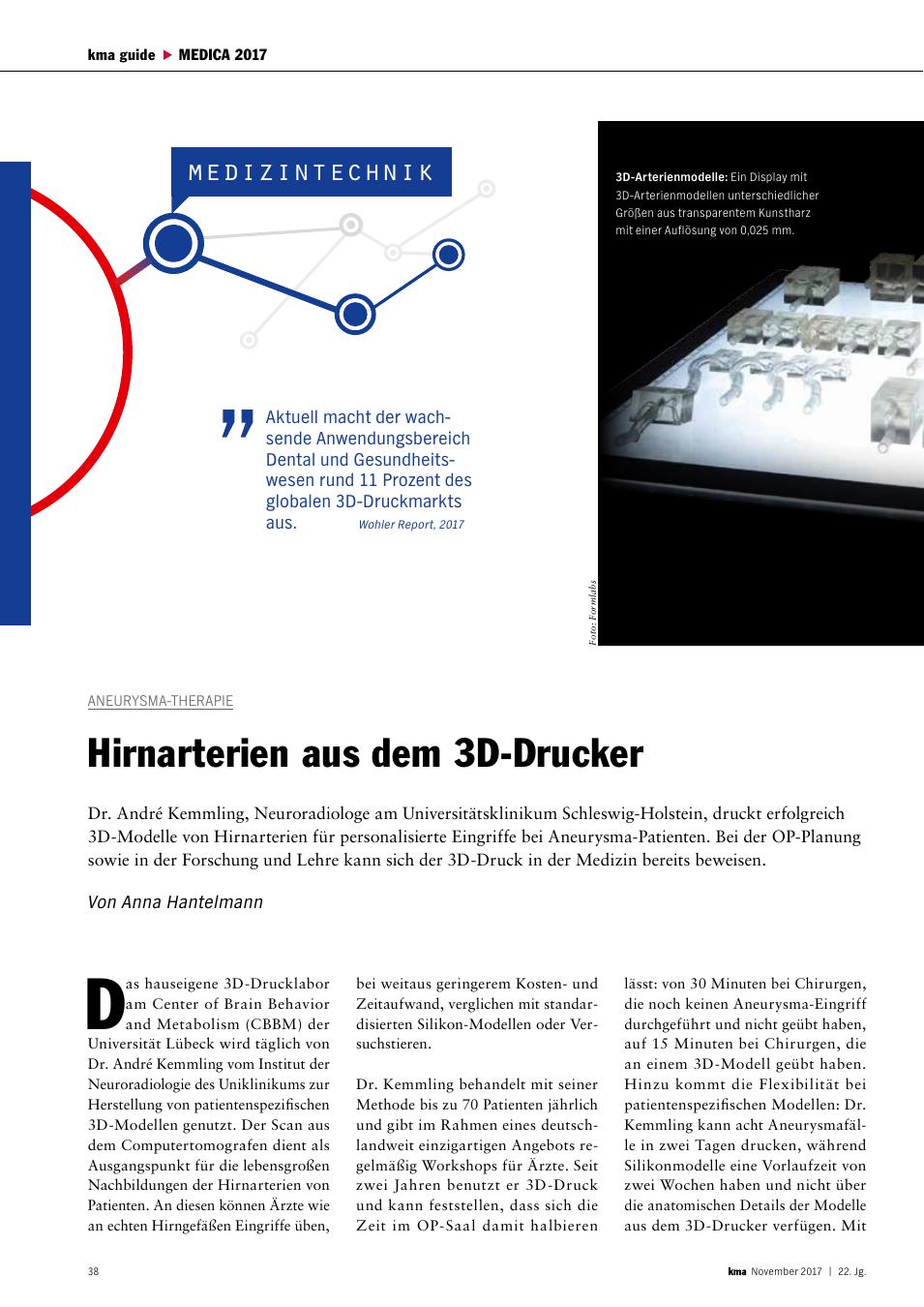 Vorschauseite 1: Aneurysma-Therapie: Hirnarterien aus dem 3D-Drucker