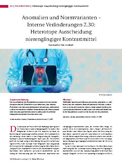 Vorschauseite 1: Anomalien und Normvarianten – Interne Veränderungen 2. 30: Heterotope Ausscheidung nierengängiger Kontrastmittel
