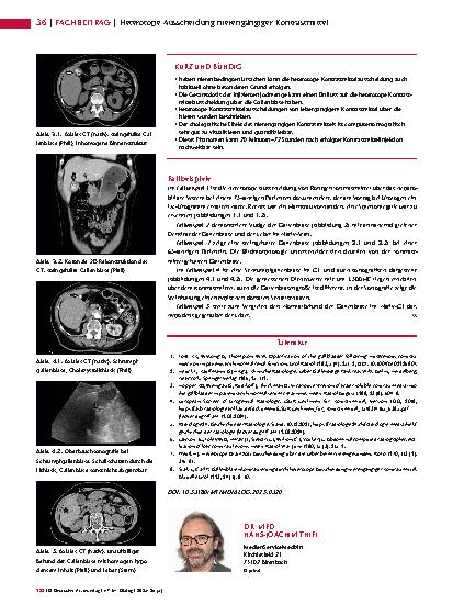 Vorschauseite 3: Anomalien und Normvarianten – Interne Veränderungen 2. 30: Heterotope Ausscheidung nierengängiger Kontrastmittel