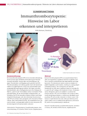Vorschauseite 1: Immunthrombozytopenie: Hinweise im Labor erkennen und interpretieren