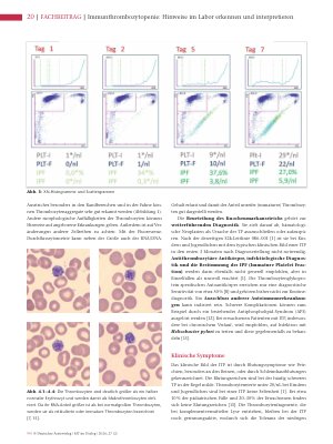 Vorschauseite 3: Immunthrombozytopenie: Hinweise im Labor erkennen und interpretieren