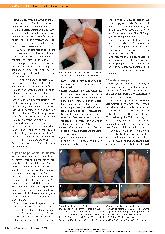 Vorschauseite 3: Fußchirurgie bei Diabetischem Fußsyndrom (DFS) - ausgewählte Konzepte der inneren Entlastung