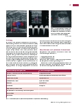 Vorschauseite 2: Nicht-invasive angiologische Diagnostik: Farbkodierte Duplexsonografie (FKDS) zur Kontrolle von Punktionskomplikationen