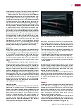 Vorschauseite 4: Nicht-invasive angiologische Diagnostik: Farbkodierte Duplexsonografie (FKDS) zur Kontrolle von Punktionskomplikationen