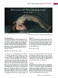 Vorschauseite 1: Tetanus oder Wundstarrkrampf