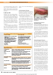 Vorschauseite 2: MARSI – durch medizinische Klebstoffe bedingte Hautverletzungen