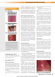 Vorschauseite 3: MARSI – durch medizinische Klebstoffe bedingte Hautverletzungen