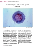Vorschauseite 1: Schimmelpilze Teil 2: Aspergillus