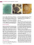 Vorschauseite 3: Schimmelpilze Teil 2: Aspergillus