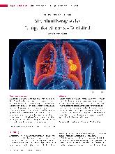 Vorschauseite 1: Strahlentherapie des Lungenkarzinoms - Revisited