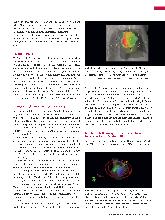 Vorschauseite 2: Strahlentherapie des Lungenkarzinoms - Revisited
