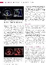 Vorschauseite 3: Strahlentherapie des Lungenkarzinoms - Revisited