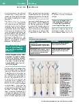 Vorschauseite 2: Einlungenventilation Correction: Einlungenventilation