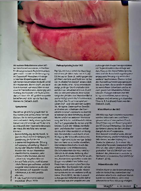 Vorschauseite 2: Anwendung eines kontinuierlichen Stuhldrainagesystems am Beispiel einer Inkontinenzassoziierten Dermatitis The text is already correctly spelled.