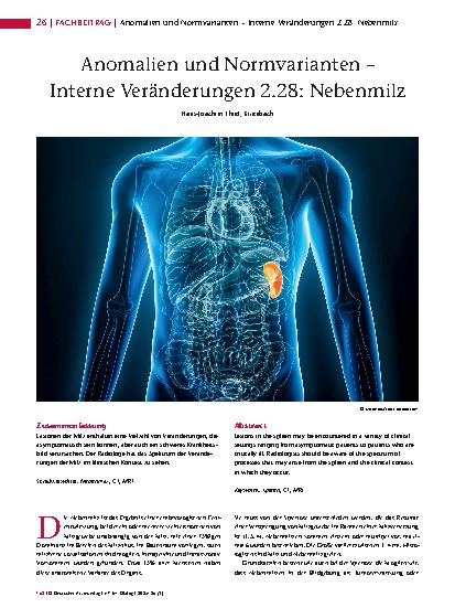 Vorschauseite 1: Anomalien und Normvarianten – Interne Veränderungen 2. 28: Nebenmilz