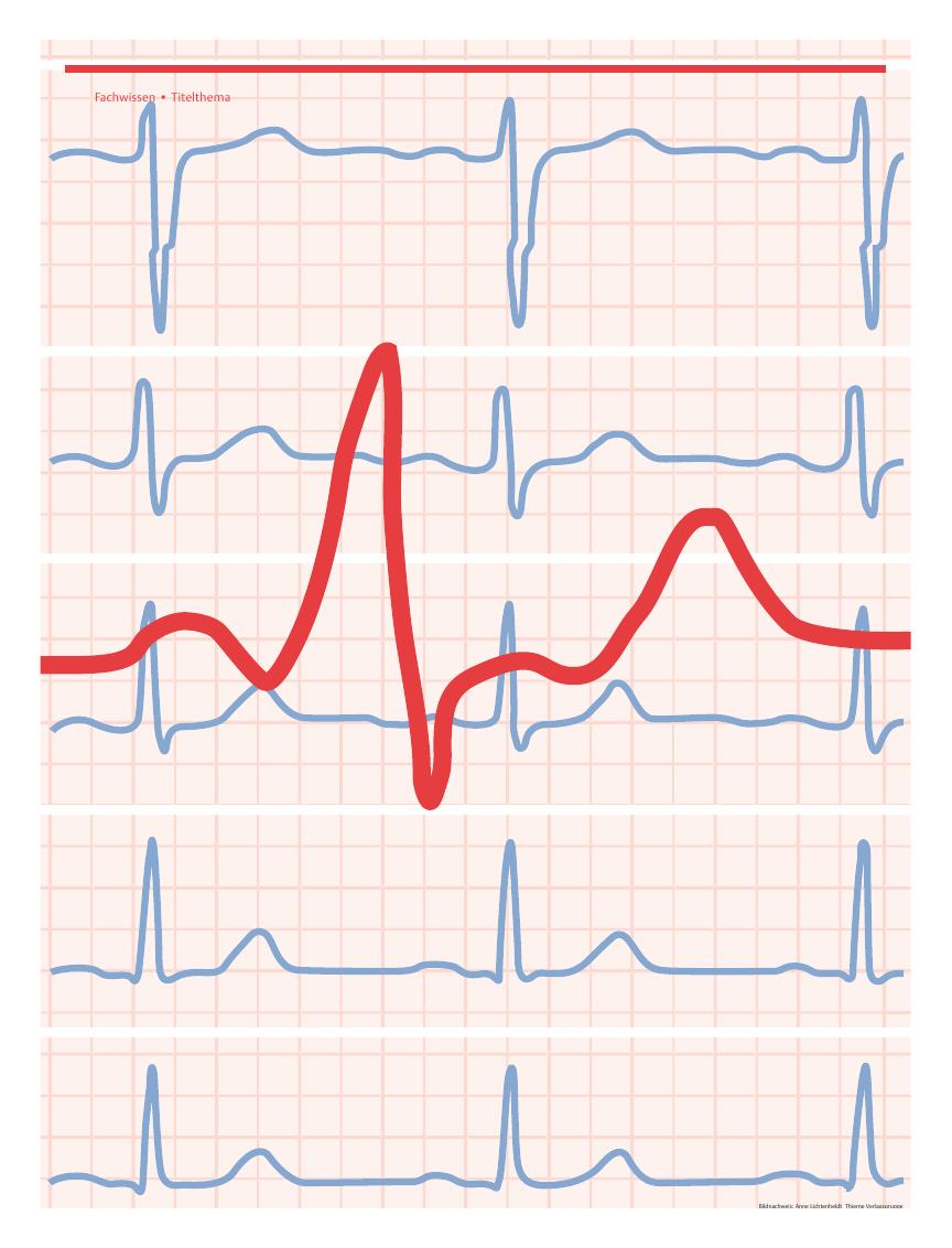 Vorschauseite 1: EKG im Rettungsdienst ? Rhythmusdiagnostik leicht gemacht
