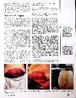 Vorschauseite 3: Guter Ansatz Hirudotherapie bei posttraumatischen Blutergüssen