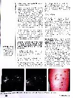Vorschauseite 4: Guter Ansatz Hirudotherapie bei posttraumatischen Blutergüssen