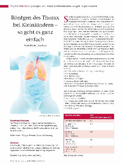Vorschauseite 1: Röntgen des Thorax bei Kleinkindern – so geht es ganz einfach