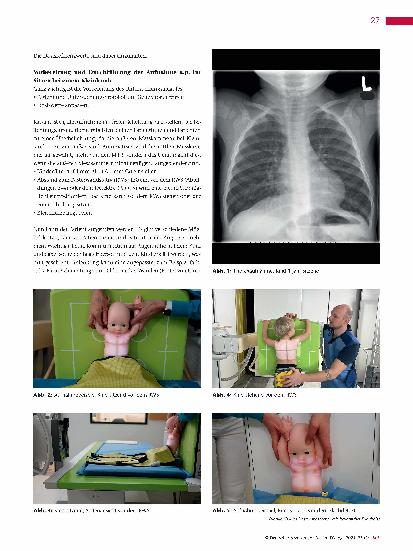 Vorschauseite 2: Röntgen des Thorax bei Kleinkindern – so geht es ganz einfach