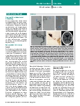 Vorschauseite 5: Anästhesiologische Versorgung von Schlaganfallpatienten während endovaskulärer Thrombektomie: Praxis und Stand der Wissenschaft