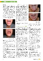 Vorschauseite 3: Fallbeispiele für Linsyndrome