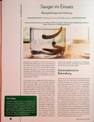 Vorschauseite 1: Sauger im Einsatz Blutegeltherapie bei Arthrose