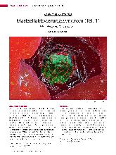 Vorschauseite 1: Mastzellaktivierungssyndrom (Teil 1) Die unbekannte Volkskrankheit