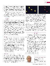 Vorschauseite 4: Toxoplasma gondii: Ein Protozoon aus der Gruppe der Sporozoa.