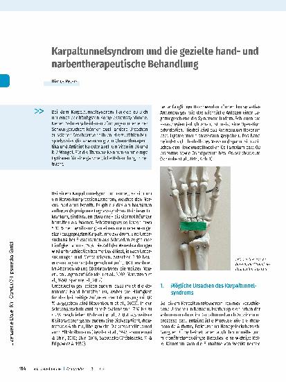 Vorschauseite 1: Karpaltunnelsyndrom und die gezielte Handund Narbentherapeutische Behandlung