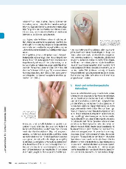 Vorschauseite 3: Karpaltunnelsyndrom und die gezielte Handund Narbentherapeutische Behandlung