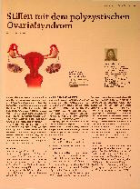 Vorschauseite 1: Stillen mit dem polyzystischen Ovarialsyndrom