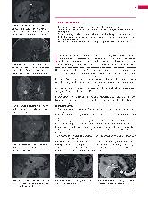 Vorschauseite 2: Anomalien und Normvarianten - Interne Veränderungen 2.22: Von Meyenburg-Komplex der Leber