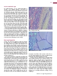 Vorschauseite 2: Autoimmunerkrankungen: Die Schilddrüse Hashimoto-Thyreoiditis und Morbus Basedow
