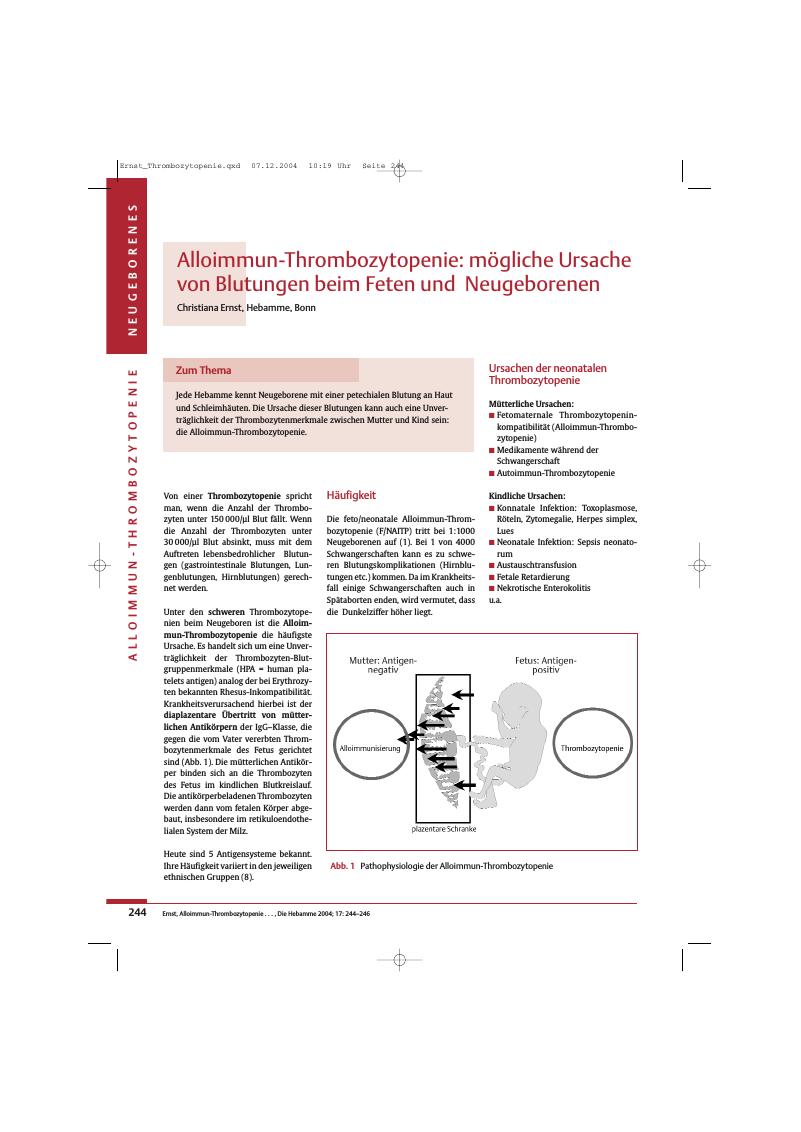 Vorschauseite 1: Alloimmun-Thrombozytopenie: mögliche Ursache von Blutungen beim Feten und Neugeborenen