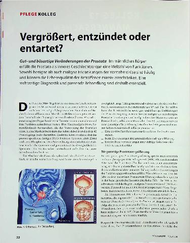 Vorschauseite 1: Vergrößert, entzündet oder entartet?