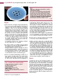 Vorschauseite 3: Histoplasma capsulatum – ein dimorpher Pilz Auflösung des Bilderrätsels aus Heft 10/2020