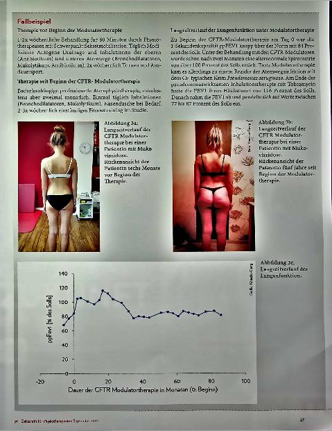 Vorschauseite 4: Update Mukoviszidose Atemphysiotherapie in Zeiten der CFTR-Modulatortherapie