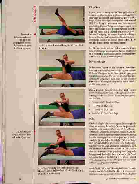 Vorschauseite 3: Muskelfaserriss der Hamstrings QJ Lu X Fallbeispiel mit Prognose und Kriterien für die Rückkehr in den Sport