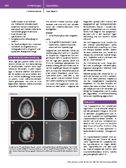 Vorschauseite 2: Pediculus et pulices: Liquorunterdrucksyndrom und kortikale Venenthrombose postpartal