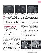 Vorschauseite 2: Anomalien und Normvarianten - Interne Veränderungen 2.20: dysontogenetische Leberzysten