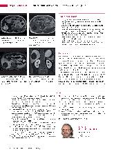 Vorschauseite 3: Anomalien und Normvarianten - Interne Veränderungen 2.20: dysontogenetische Leberzysten