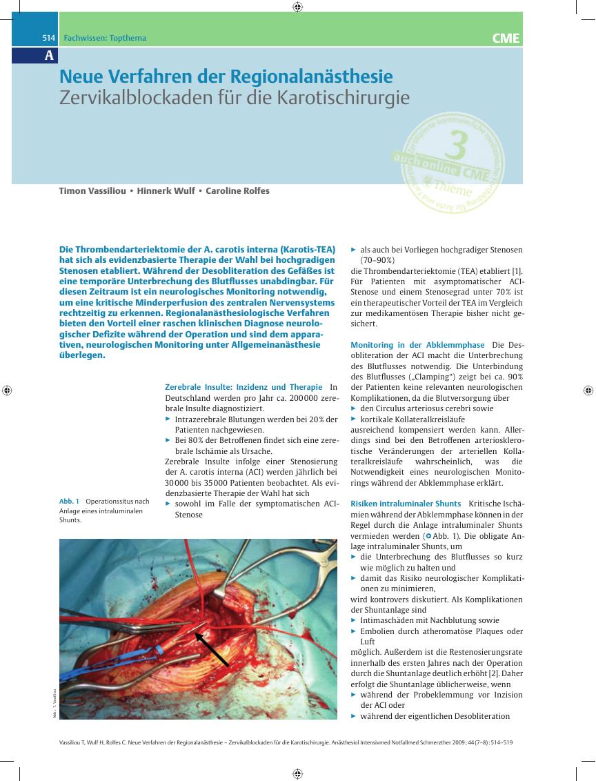Vorschauseite 1: Neue Verfahren der Regionalanästhesie – Zervikalblockaden für die Karotischirurgie